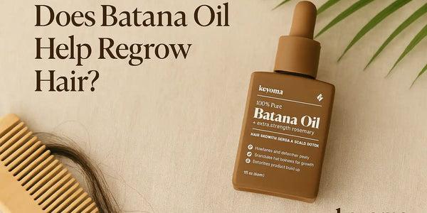 A clean banner showing Keyoma’s Batana Oil as a natural hair regrowth option.
