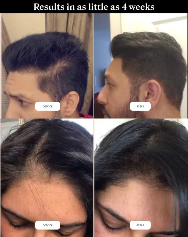 batana oil before and after