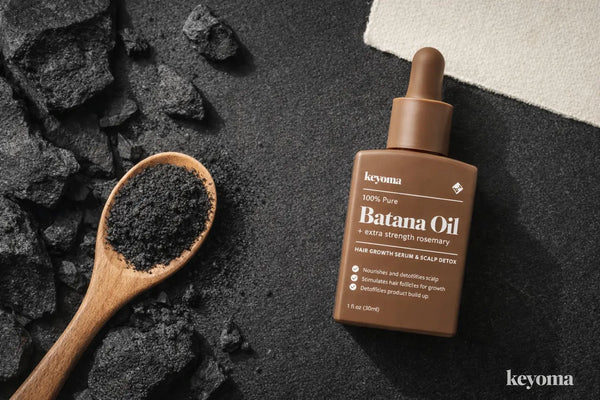 Flatlay shows charcoal powder and Keyoma batana oil highlighting detox scalp care and oil balance.