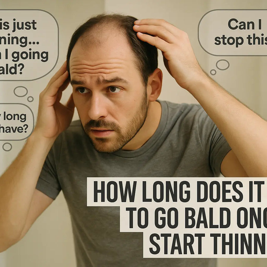 A man examines his thinning scalp in the mirror, reflecting on questions about balding timeline, featured in Keyoma’s insights on early hair loss.