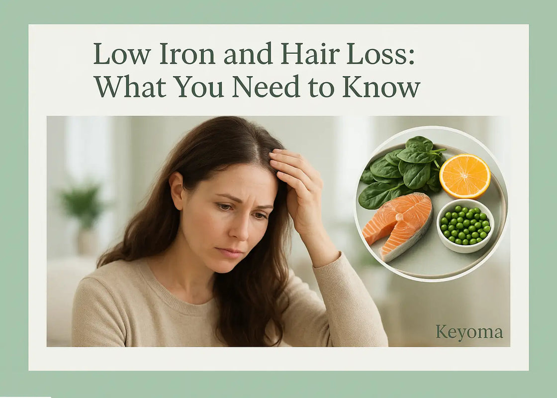  A Keyoma image showing a concerned woman touching her hair, with an inset of iron-rich foods like salmon, spinach, oranges, and peas, illustrating the link between low iron and hair loss.          Ask ChatGPT
